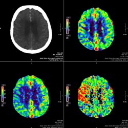 Neuroradiologie